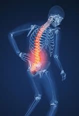 Chiropractic Care Substantially Reduces Opiate Use for Back Pain