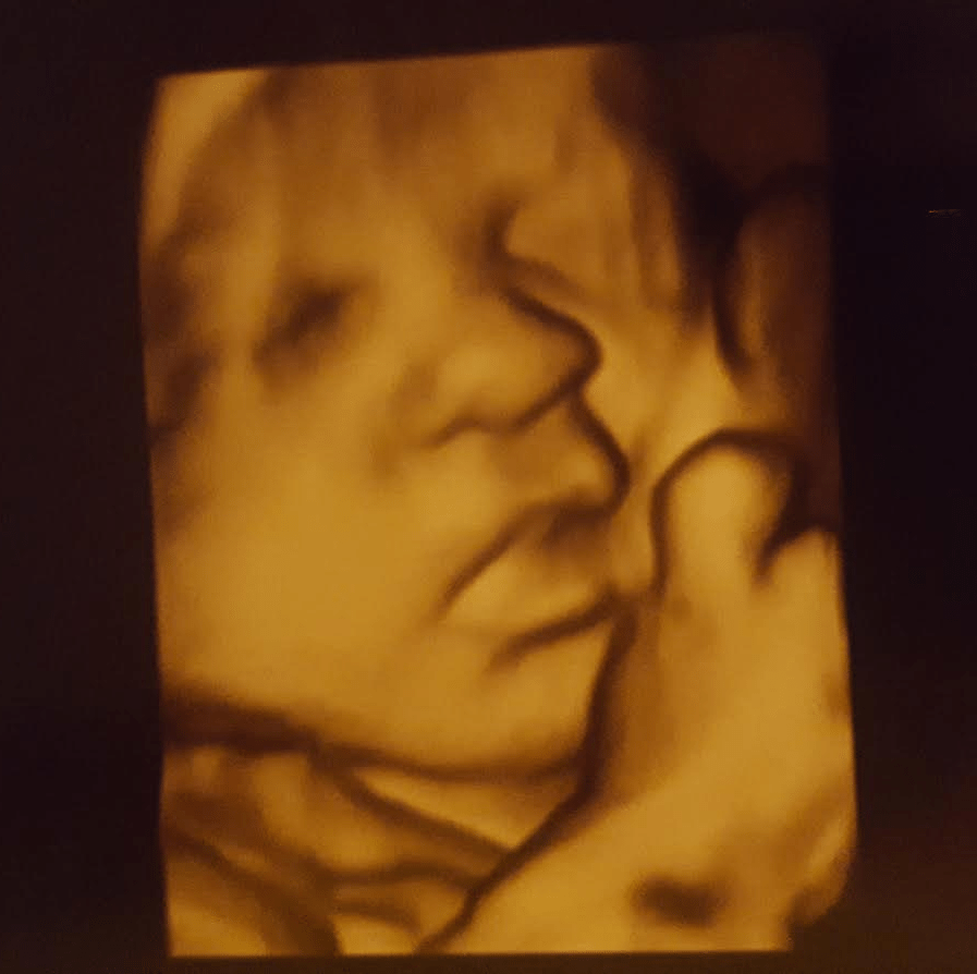 Baby Hayden Week 34 Update – Back to Philadelphia