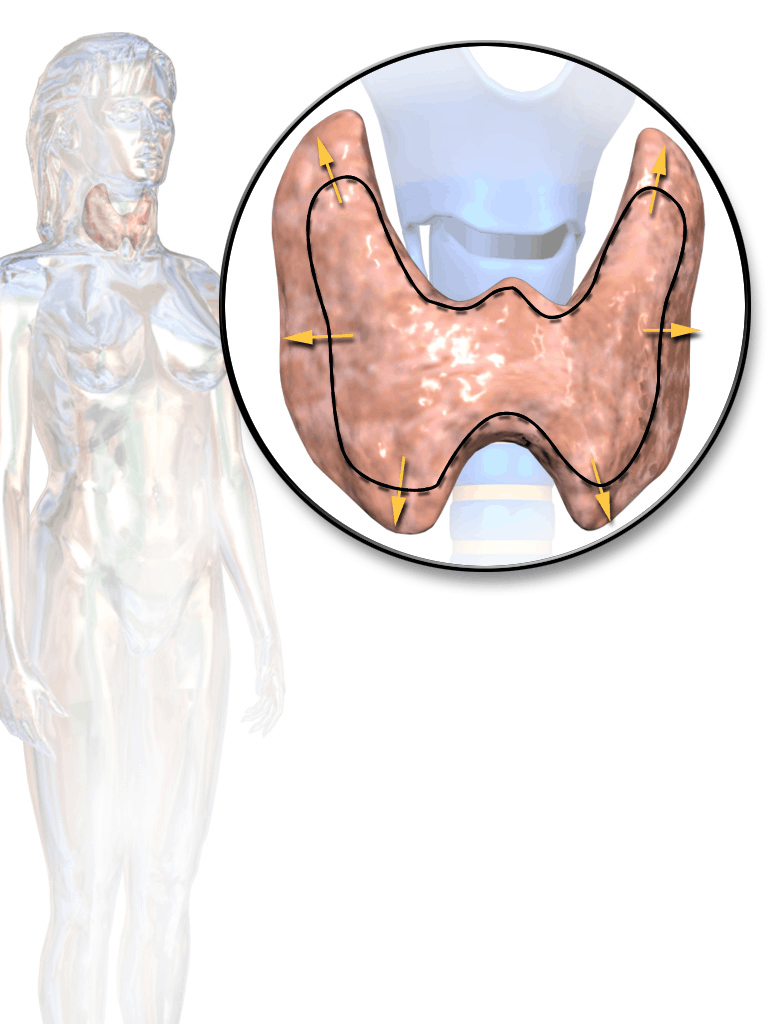 Thyroid Hormone Imbalance – Hypothyroidism and Hyperthyroidism Basics